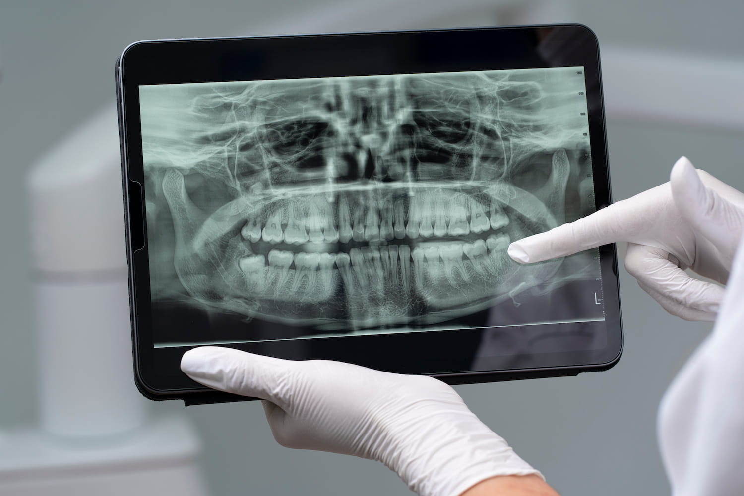 Instrumentar pentru implantologie dentară — Betadent Clinic Cluj-Napoca