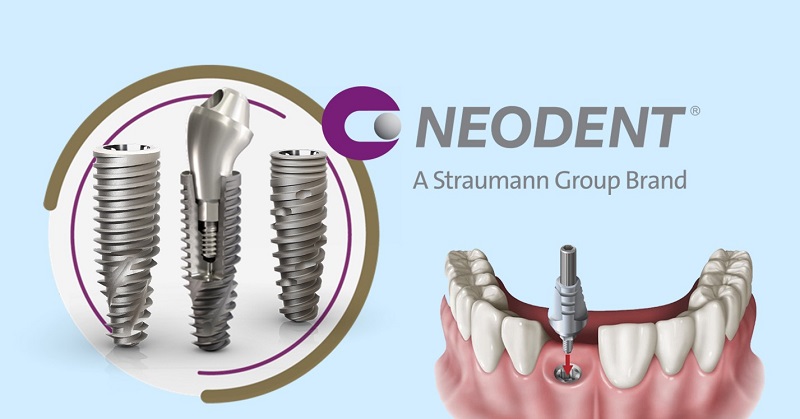 Implant Straumann Neodent Betadent Clinic