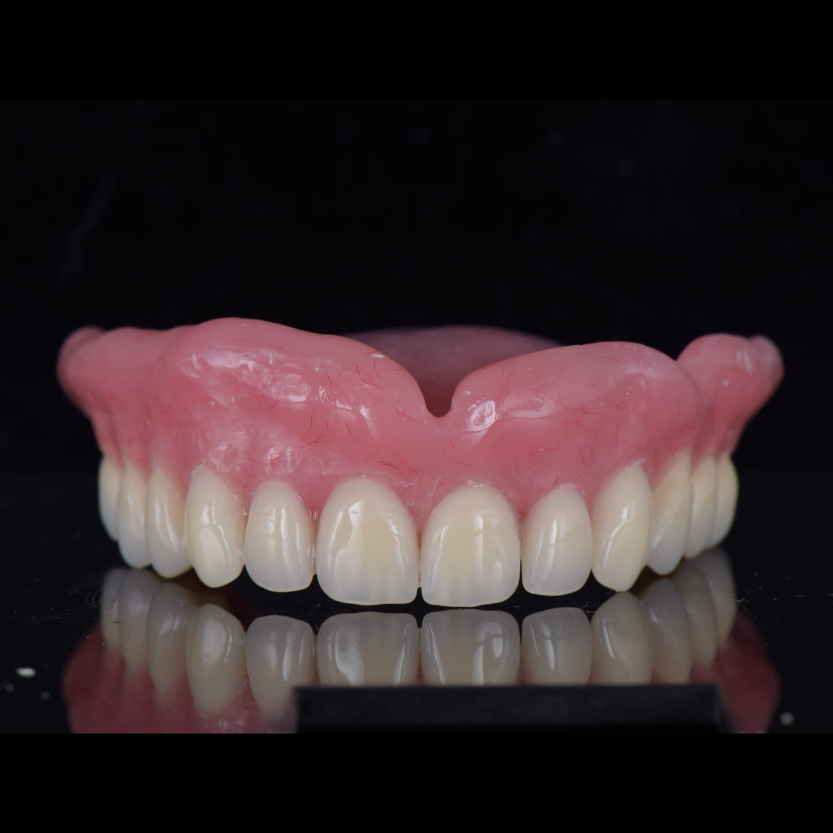 Caz Dna. M. — Betadent Clinic Cluj (imaginea 4 din 5)